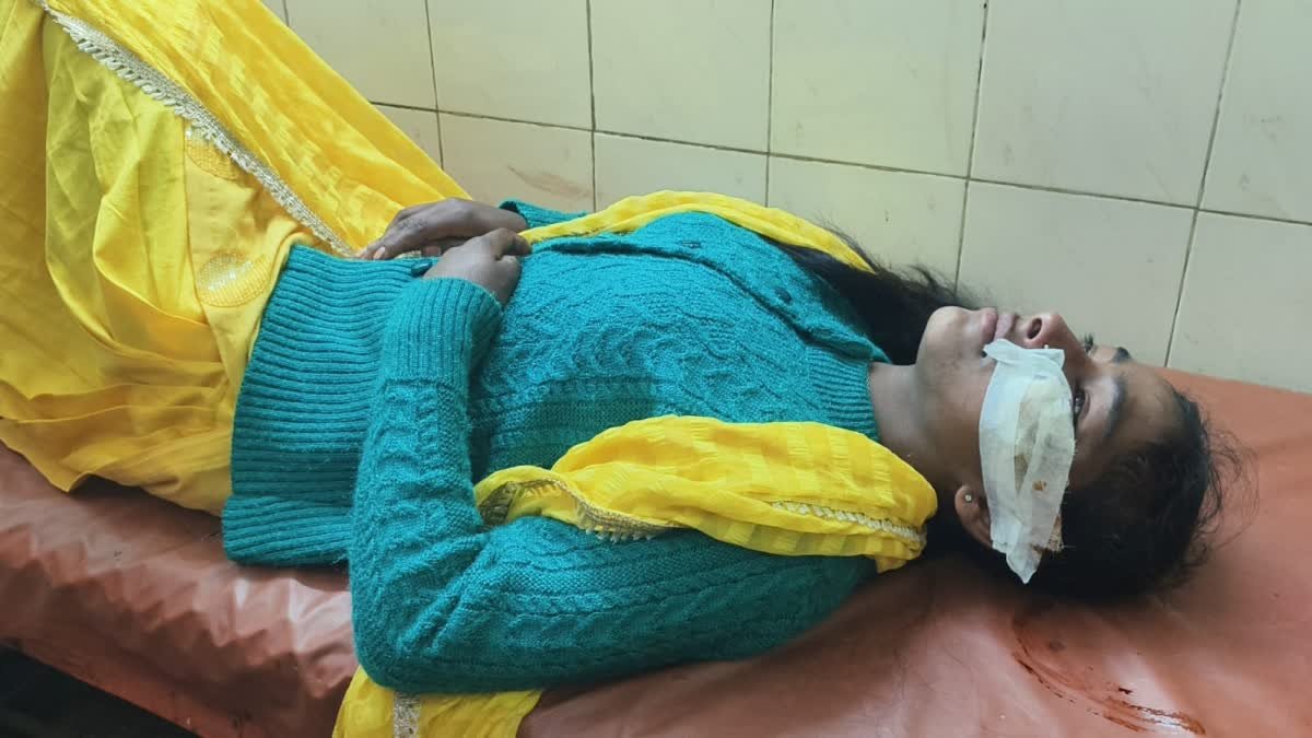 गुलदार के हमले में मूकबधिर युवती घायल, अस्पताल में उपजार जारी